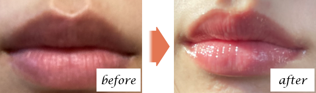Before After